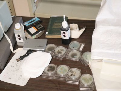 De vieux documents ont parfois été mal conservés avant d'arriver aux Archives du Calvados, et peuvent notamment développer des moisissures.